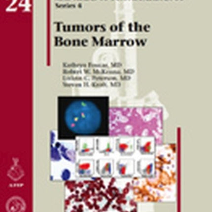 Tumors of the Bone Marrow