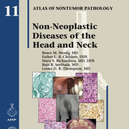 Non-Neoplastic Diseases of the Head and Neck