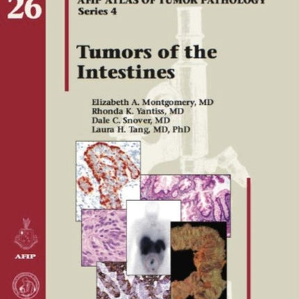 Tumors of the Intestines