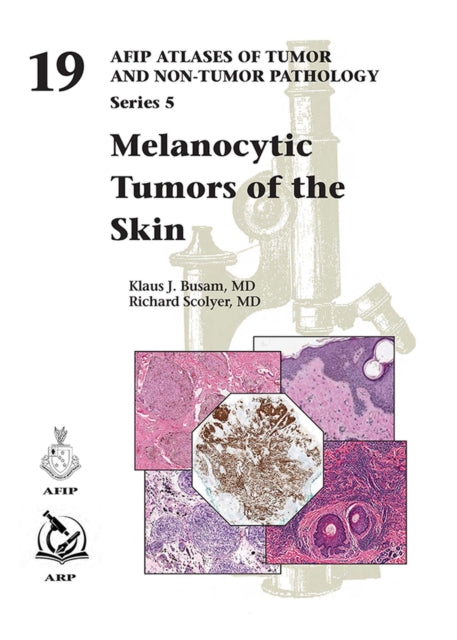 Melanocytic Tumors of Skin