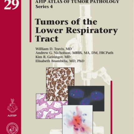 Tumors of the Lower Respiratory Tract