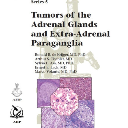 Tumors of the Adrenal Glands and ExtraAdrenal