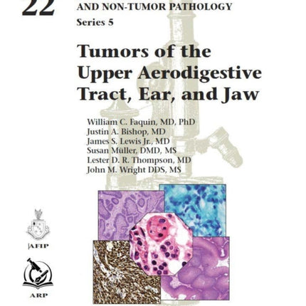Tumors of the Upper Aerodigestive Tract Ear and