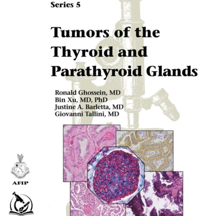 Tumors of the Thyroid and Parathyroid Glands