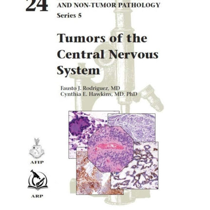 Tumors of the Central Nervous System