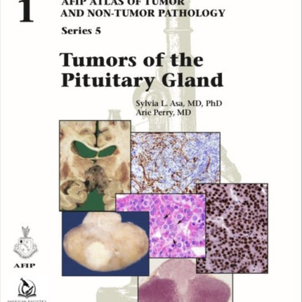 Tumors of the Pituitary Gland