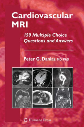Cardiovascular MRI: 150 Multiple-Choice Questions