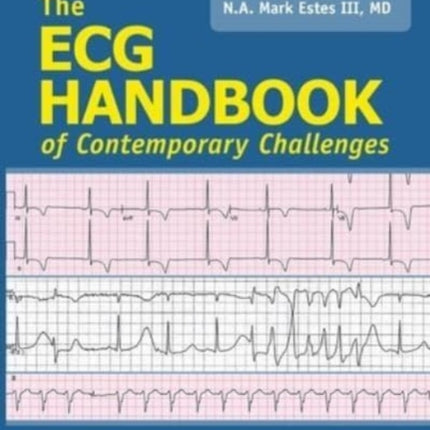 ECG Handbook of Contemporary Challenges