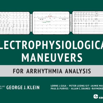 Electrophysiological Maneuvers for Arrhythmia