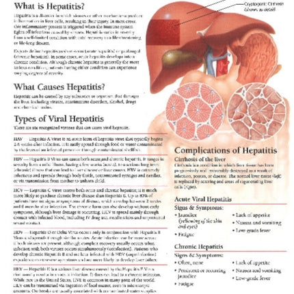 Understanding Hepatitis Model