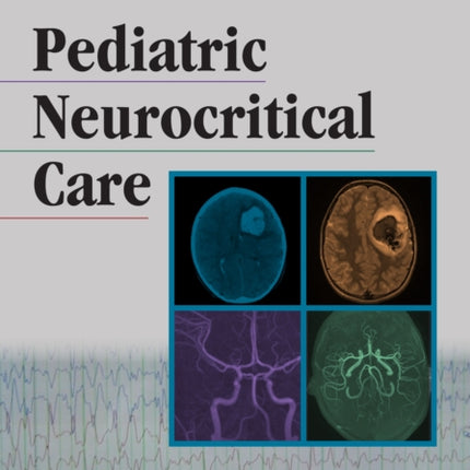 Pediatric Neurocritical Care