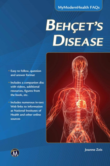 Behcets Disease MyModernHealth FAQ Series