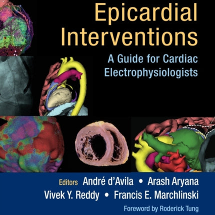 Percutaneous Epicardial Interventions: A Guide