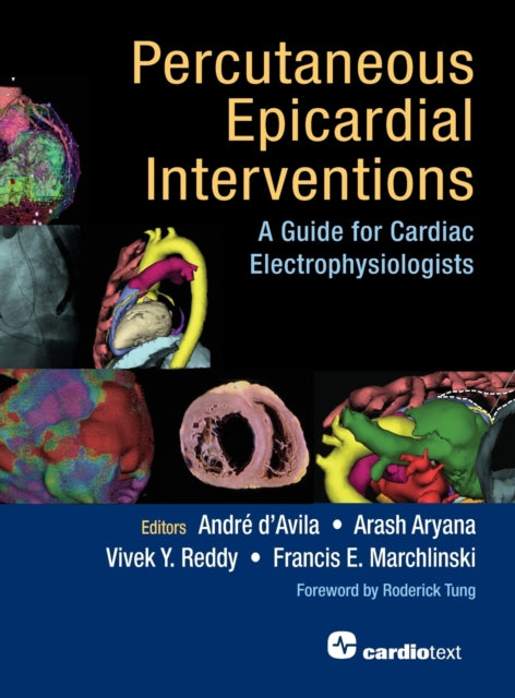 Percutaneous Epicardial Interventions: A Guide