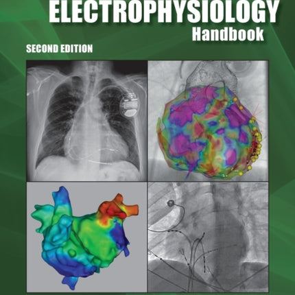 The Clinical Cardiac Electrophysiology Handbook,