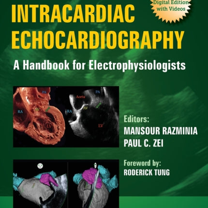 Intracardiac Echocardiography: A Handbook for