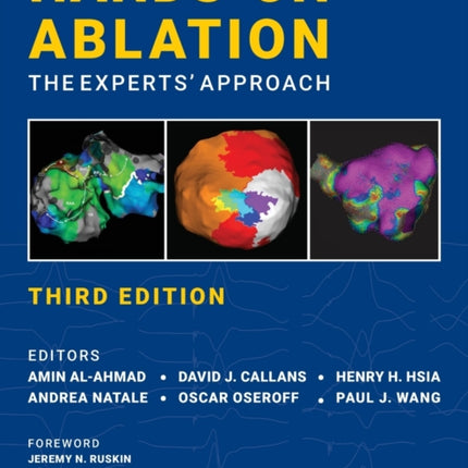 Hands-On Ablation: The Experts' Approach, Third