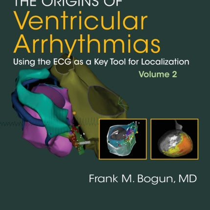 The Origins of Ventricular Arrhythmias, Volume 2:
