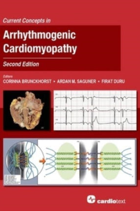 Current Concepts in Arrhythmogenic