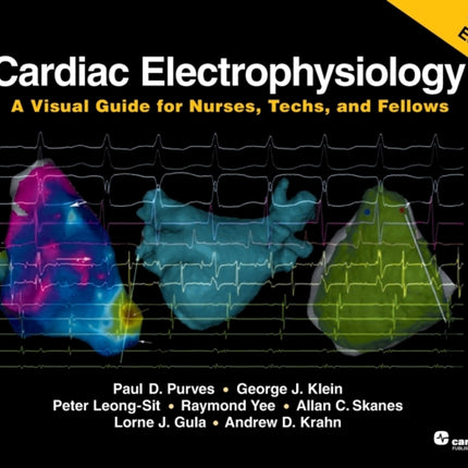 Cardiac Electrophysiology , Second Edition: A