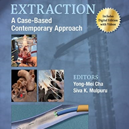 Cardiac Lead Extraction: A Case-Based