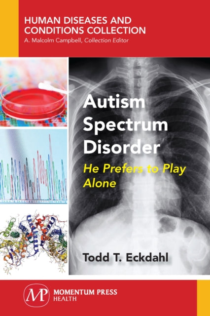Autism Spectrum Disorder: He Prefers to Play Alone