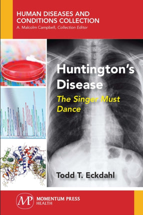 Huntington's Disease: The Singer Must Dance