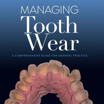 Managing Tooth Wear