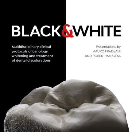 Black  White