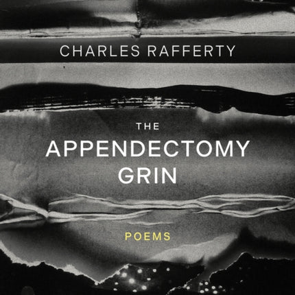The Appendectomy Grin