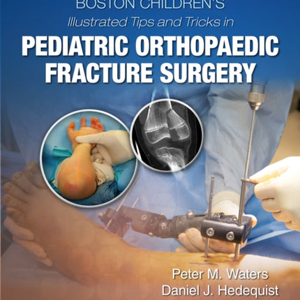 Boston Children’s Illustrated Tips and Tricks  in Pediatric Orthopaedic Fracture Surgery