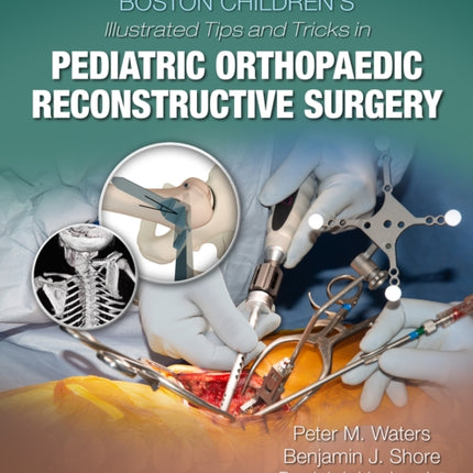 Boston Children's Illustrated Tips and Tricks in Pediatric Orthopaedic Reconstructive Surgery