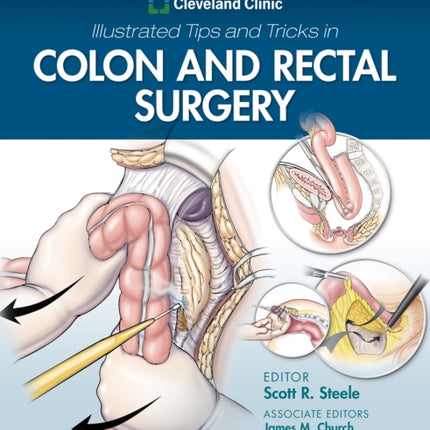 Cleveland Clinic Illustrated Tips and Tricks in Colon and Rectal Surgery