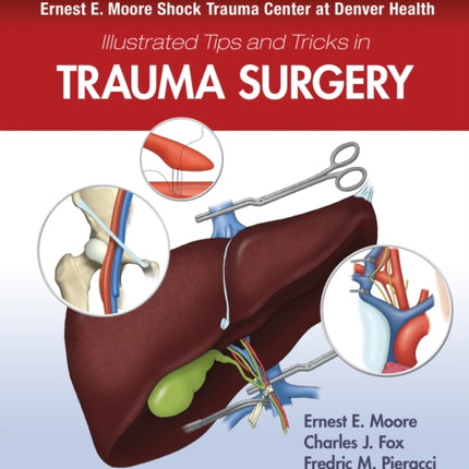 Ernest E. Moore Shock Trauma Center at Denver Health Illustrated Tips and Tricks in Trauma Surgery