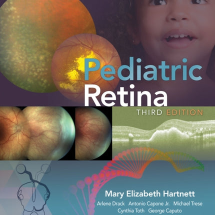 Pediatric Retina