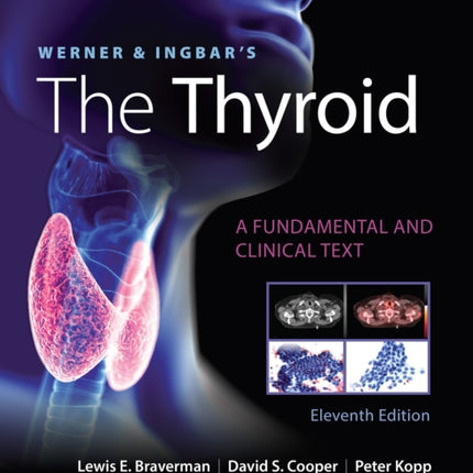 Werner & Ingbar's The Thyroid