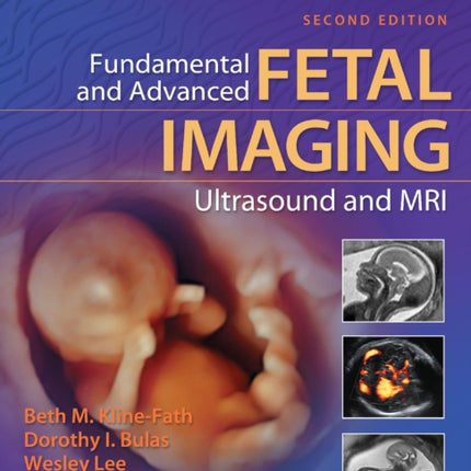 Fundamental and Advanced Fetal Imaging Ultrasound and MRI