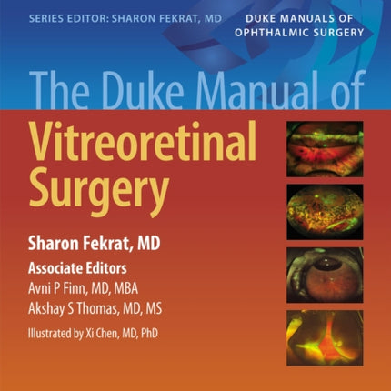 The Duke Manual of Vitreoretinal Surgery