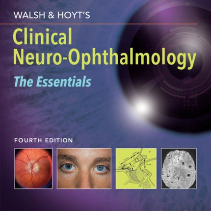 Walsh & Hoyt's Clinical Neuro-Ophthalmology: The Essentials