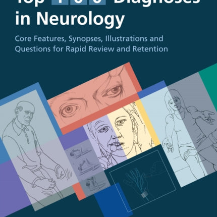 Top 100 Diagnoses in Neurology