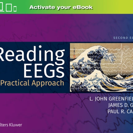 Reading EEGs: A Practical Approach