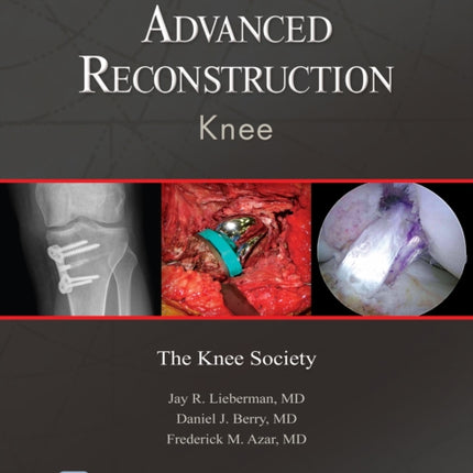 Advanced Reconstruction: Knee: Print + Ebook with Multimedia