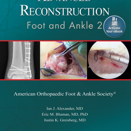 Advanced Reconstruction: Foot and Ankle 2: Print + Ebook