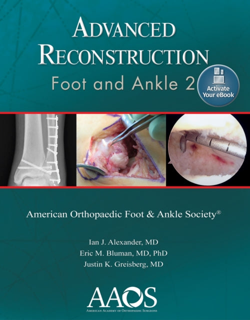 Advanced Reconstruction: Foot and Ankle 2: Print + Ebook