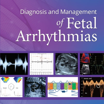 Diagnosis and Management of Fetal Arrhythmias