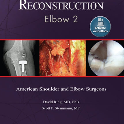 Advanced Reconstruction: Elbow 2: Print + Ebook with Multimedia