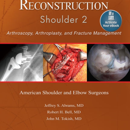 Advanced Reconstruction: Shoulder 2: Print + Ebook with Multimedia