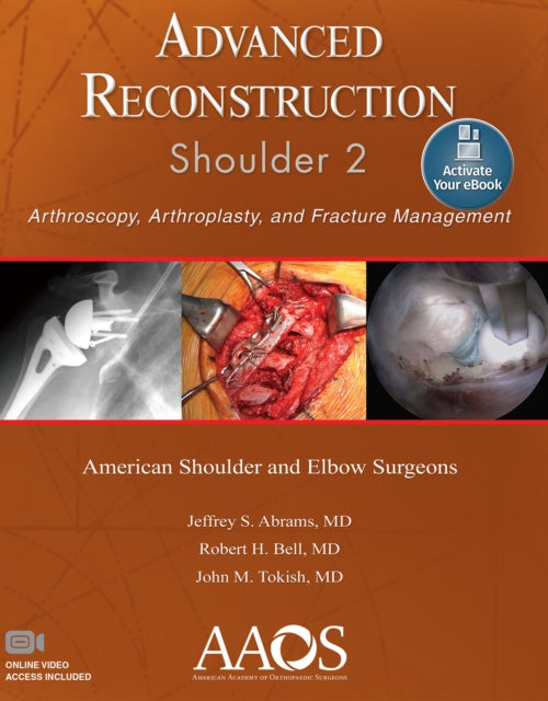 Advanced Reconstruction: Shoulder 2: Print + Ebook with Multimedia