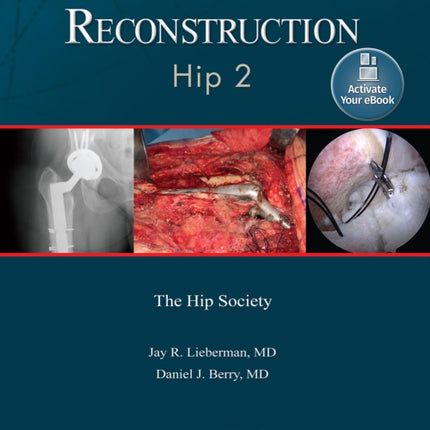 Advanced Reconstruction: Hip 2: Print + Ebook with Multimedia