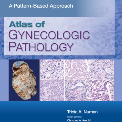 Atlas of Gynecologic Pathology: A Pattern-Based Approach